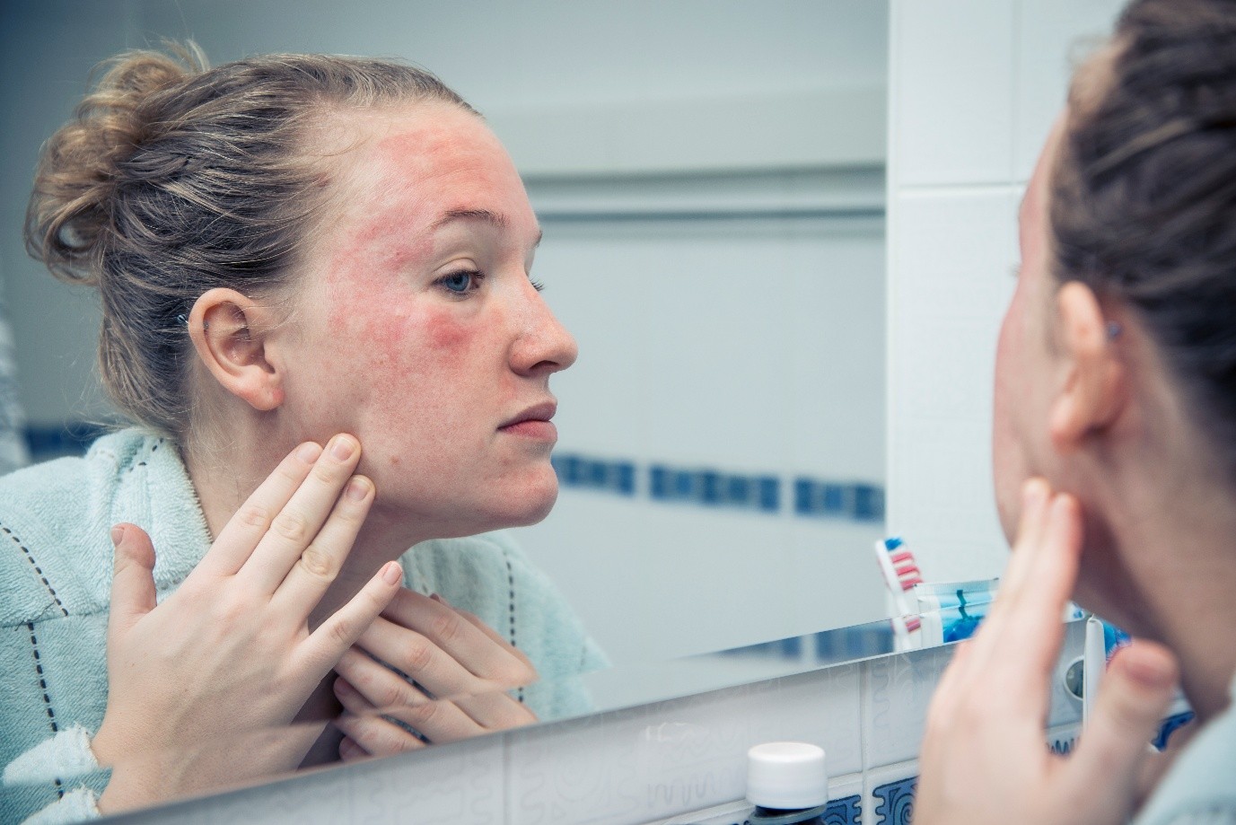 Skin problems caused by fake cosmetics